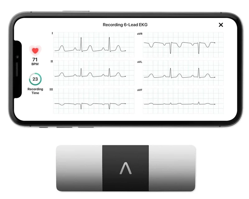KardiaMobile 6L ECG tascabile a 6 derivazioni OMRON