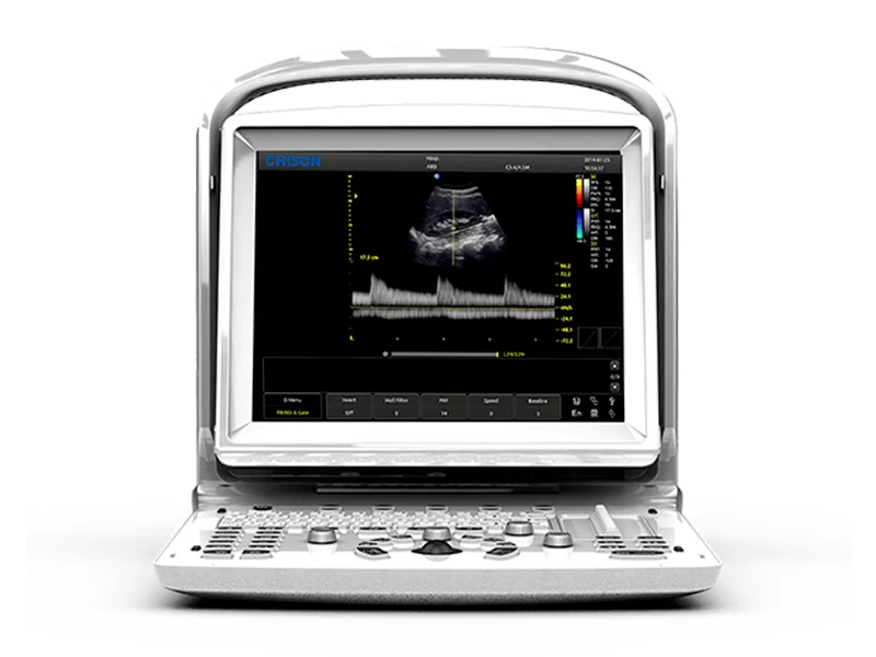 Ecografo Chison ECO3 - 2 connettore sonda (sonde non incluse)