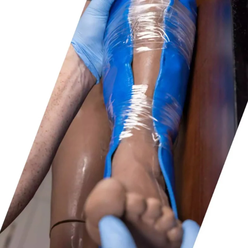 Stecca modellabile in alluminio Prometheus Omni Splint™