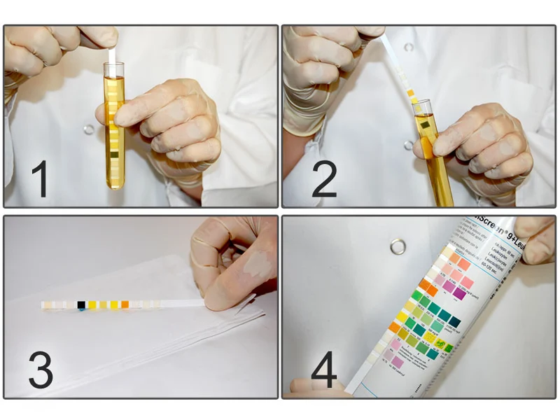 Strisce urine 10 parametri Combi Screen prive di protezione dall'acido ascorbico - conf.150 pz.