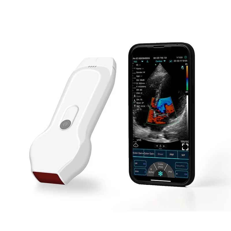 Ecografo Color-Doppler palmare ECOLESS EL-CD21B1 con Sonda Cardiaca 2 in 1
