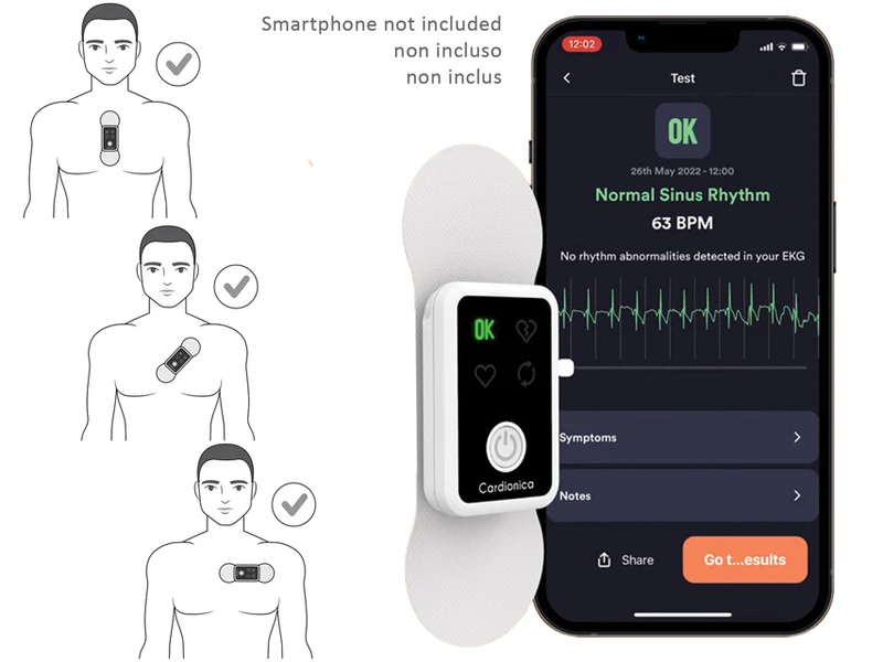 ECG portatile a singolo canale con Afib e Bluetooth Cardionica® MIR