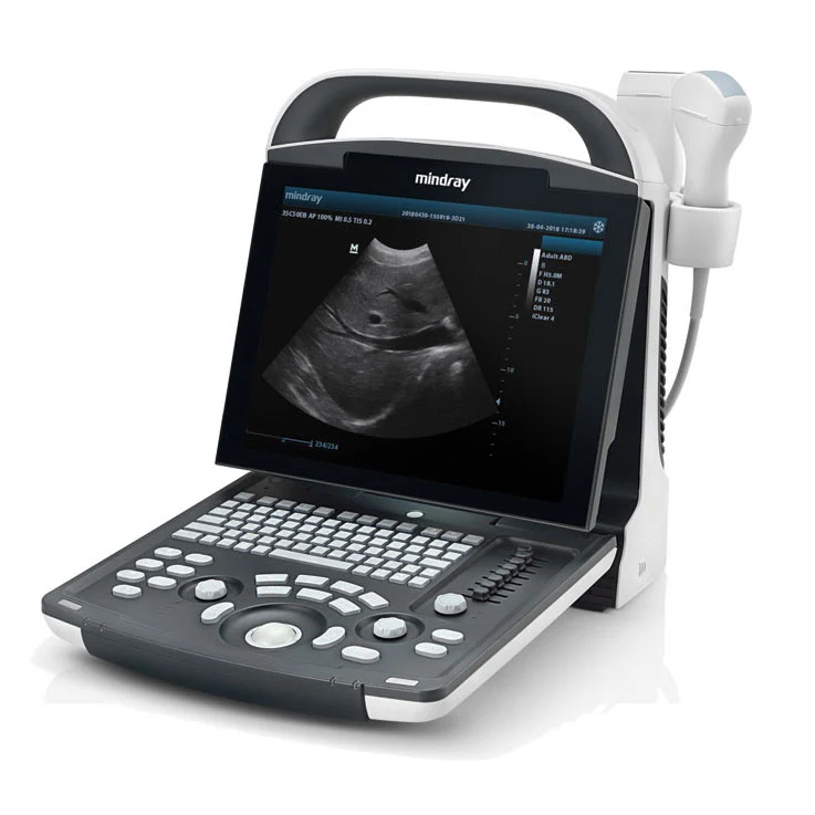 Ecografo portatile MINDRAY DP20 - senza sonde + Doppler Pulsato